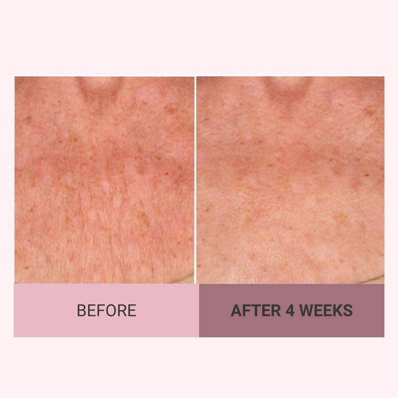 💆♀️ Experience Ultimate Luxury - 50% OFF - ✨ Champagne Beaute Lift Firming Body Crème - For Firmer, Smoother, Radiant Skin!