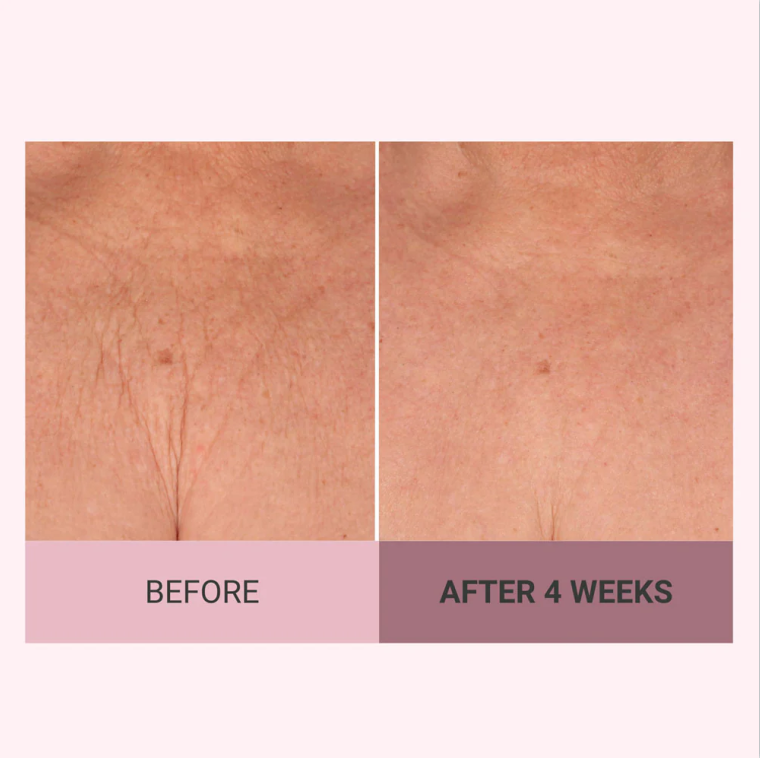 💆♀️ Experience Ultimate Luxury - 50% OFF - ✨ Champagne Beaute Lift Firming Body Crème - For Firmer, Smoother, Radiant Skin!