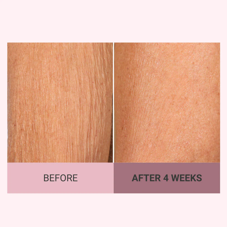💆♀️ Experience Ultimate Luxury - 50% OFF - ✨ Champagne Beaute Lift Firming Body Crème - For Firmer, Smoother, Radiant Skin!