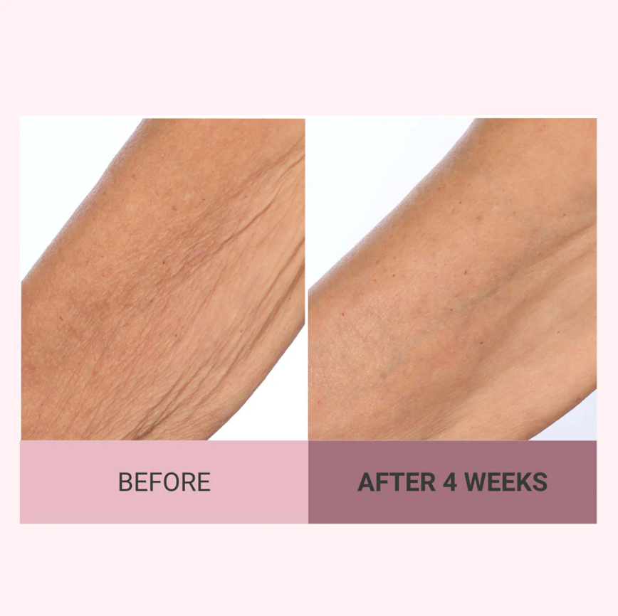 💆♀️ Experience Ultimate Luxury - 50% OFF - ✨ Champagne Beaute Lift Firming Body Crème - For Firmer, Smoother, Radiant Skin!