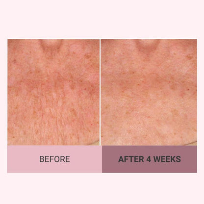 💆‍♀️ Experience Ultimate Luxury - 50% OFF - ✨ Champagne Beaute Lift Firming Body Crème - For Firmer, Smoother, Radiant Skin!